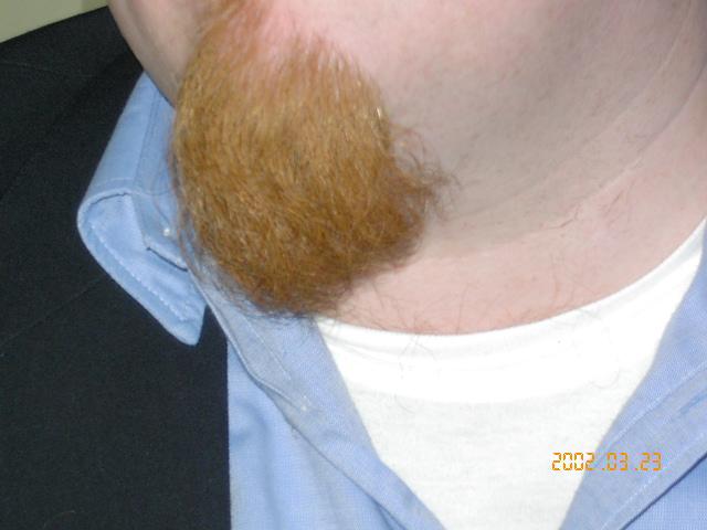 ginger_beard